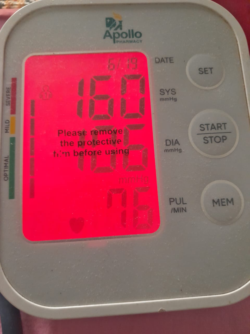 43F Recurrent tinea corporis, metabolic syn, GAD 20 years WB PaJR